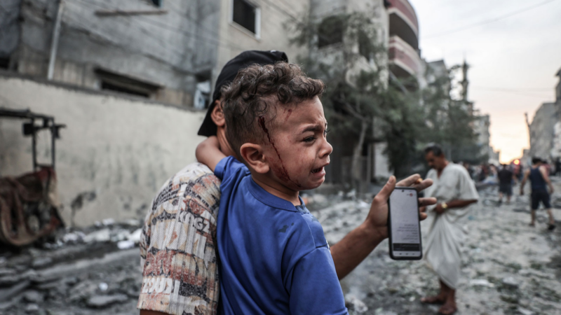 Seorang anak Palestina yang terluka digambarkan dalam sebuah foto setelah serangan udara Israel di kamp pengungsi al-Shati di Gaza pada 9 Oktober 2023 lalu. Ali Jadallah/Anadolu Agency/CNN/Getty Images