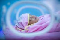 Bayi prematur meninggal dunia diduga setelah dijadikan konten newborn photography oleh sebuah klinik di Tasikmalaya. Foto: Ilustrasi bayi prematur. 