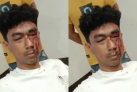 Tangkap layar kondisi Saddan Achmed Arjuna Puken yang diduga dikeroyok oleh 3 anggota Brimob di Alor, NTT. Foto: Tajukflores.com/Instagram @mega.gxvr
