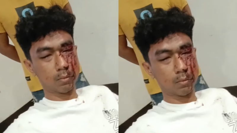 Tangkap layar kondisi Saddan Achmed Arjuna Puken yang diduga dikeroyok oleh 3 anggota Brimob di Alor, NTT. Foto: Tajukflores.com/Instagram @mega.gxvr